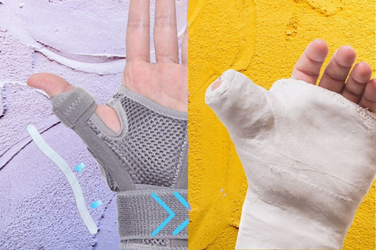 Thumb Spica Splint vs Cast: Which One Do You Need?