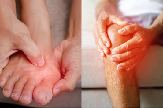Can Bunions Cause Knee Pain? Why Your Foot Problem Might Be Traveling Up Your Leg