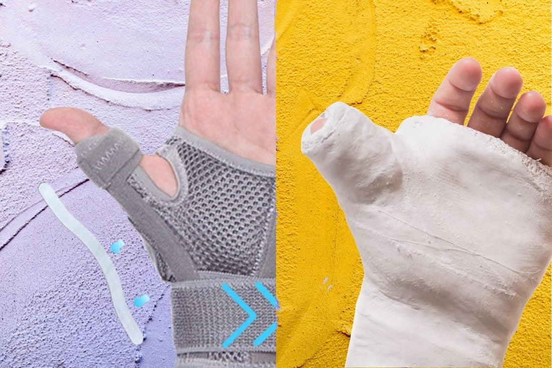 Thumb Spica Splint vs Cast: Which One Do You Need?