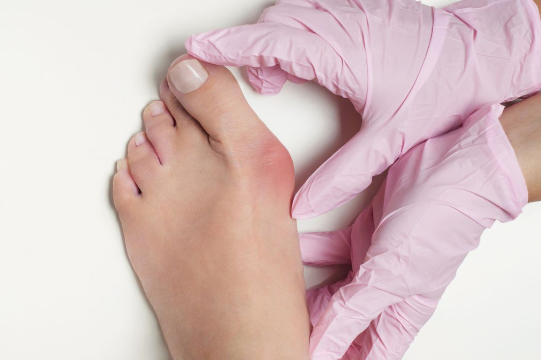 What to Know About Minimally Invasive Bunion Surgery: Procedure, Recovery & Considerations