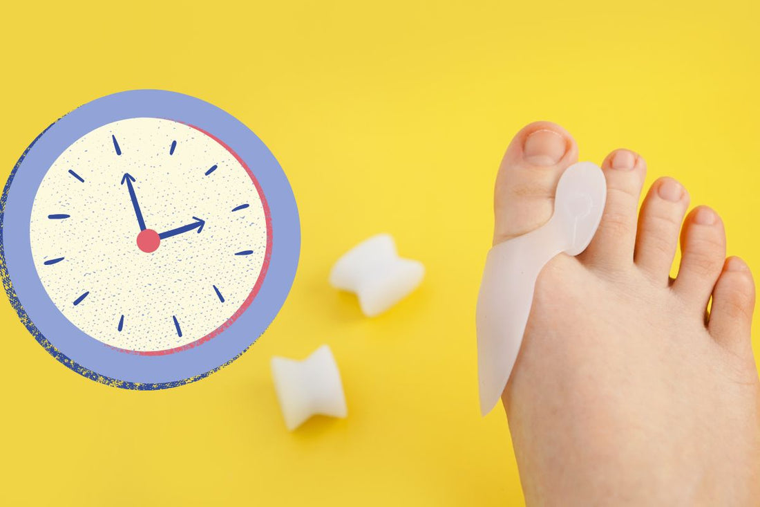 How Long Does It Take for a Bunion Splint to Correct Your Toe?