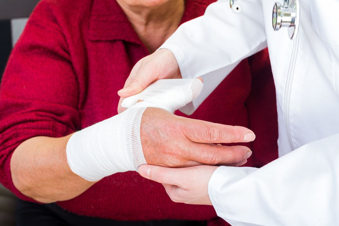 How to Wrap a Thumb Sprain: A Step-by-Step Guide to Support Recovery, and Relief
